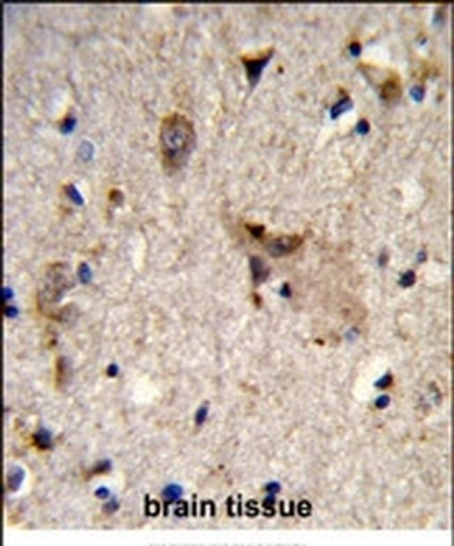 ALDH18A1 Antibody in Immunohistochemistry (IHC)