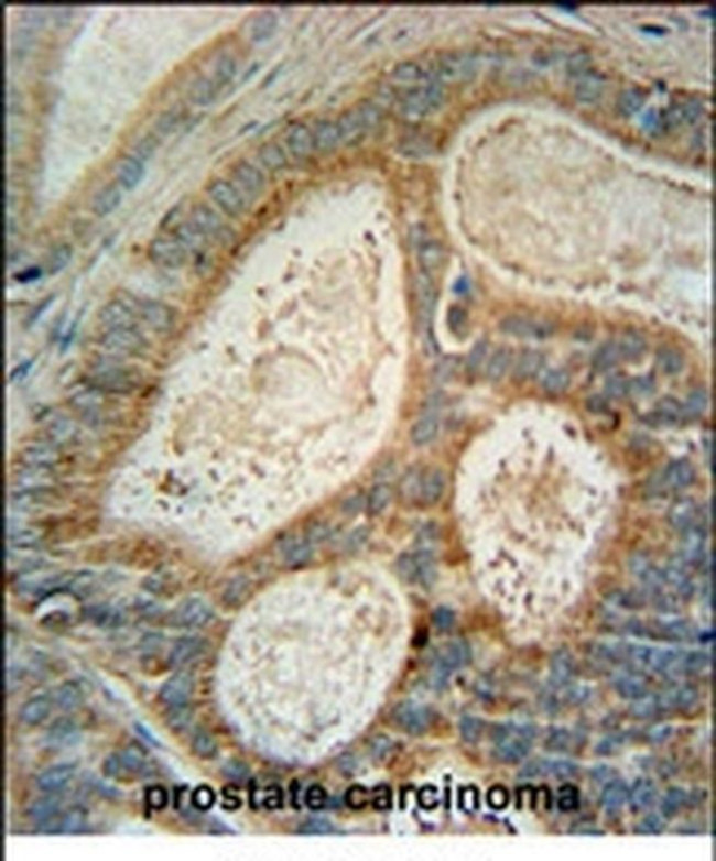 INSIG1 Antibody in Immunohistochemistry (IHC)