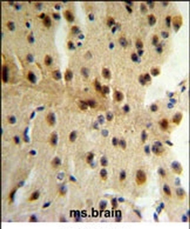 CLIP1 Antibody in Immunohistochemistry (IHC)