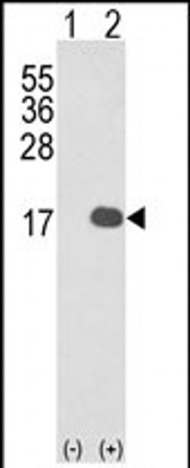 IL36B Antibody in Western Blot (WB)