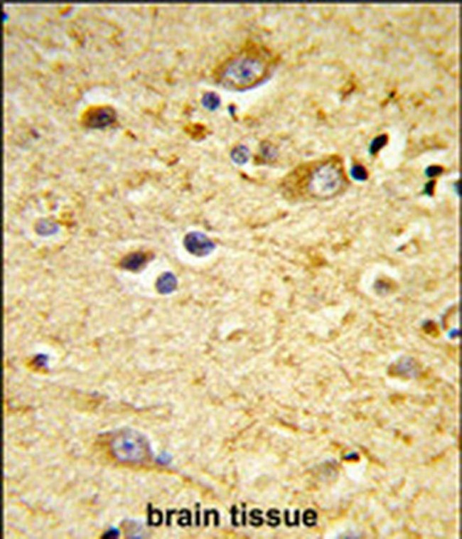 GSTA4 Antibody in Immunohistochemistry (IHC)