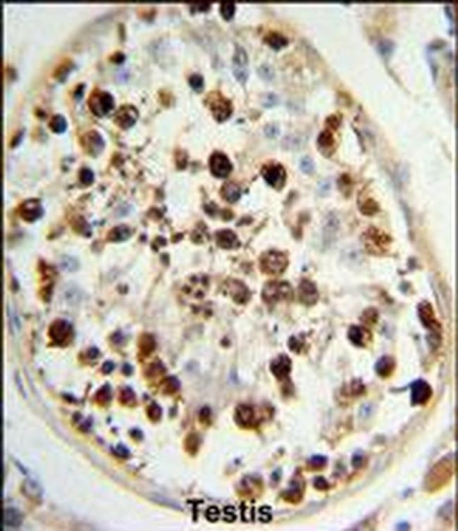 SKA3 Antibody in Immunohistochemistry (IHC)