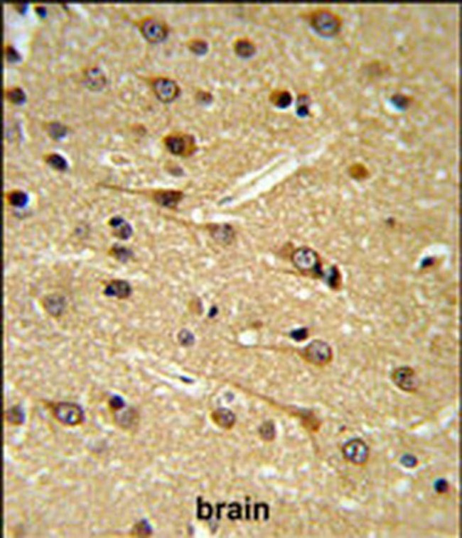 DPP10 Antibody in Immunohistochemistry (IHC)