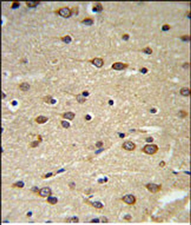 DLK2 Antibody in Immunohistochemistry (IHC)