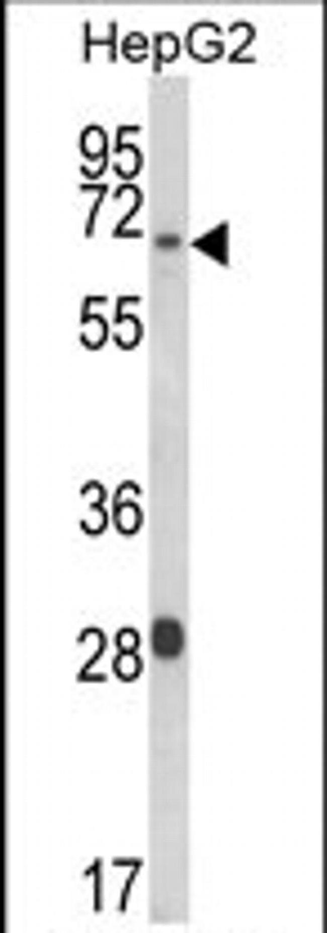 WAC Antibody in Western Blot (WB)