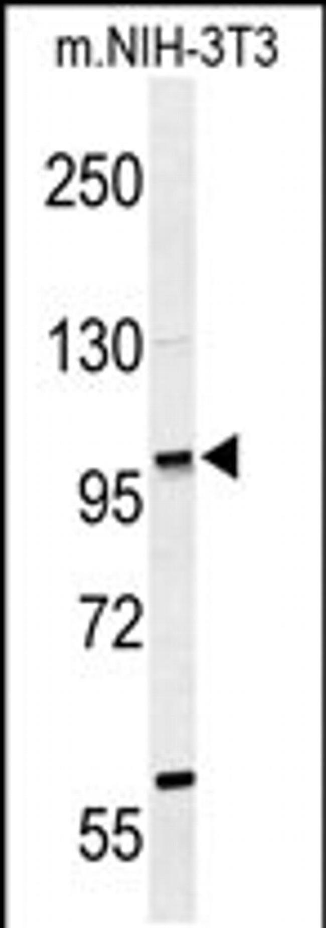 ZNF451 Antibody in Western Blot (WB)
