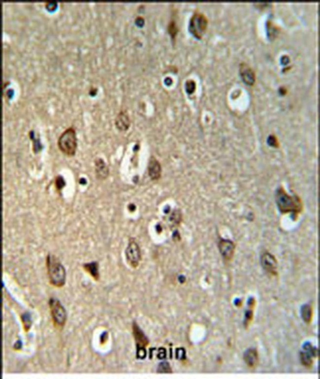 UPK1B Antibody in Immunohistochemistry (IHC)