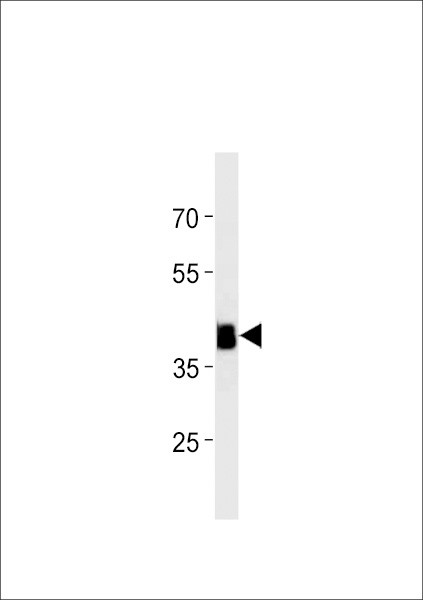 HOXC11A Antibody in Western Blot (WB)
