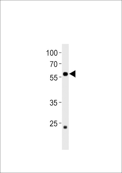 CCDC149B Antibody in Western Blot (WB)
