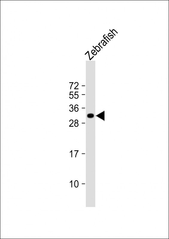 HOXB8B Antibody in Western Blot (WB)