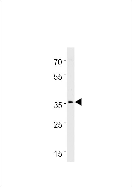 HOXC13A Antibody in Western Blot (WB)