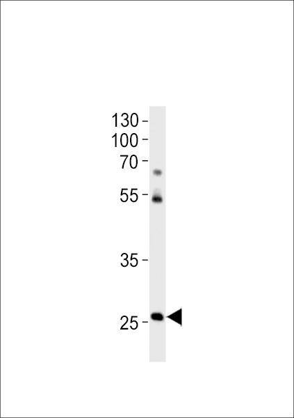 HOXC4A Antibody in Western Blot (WB)