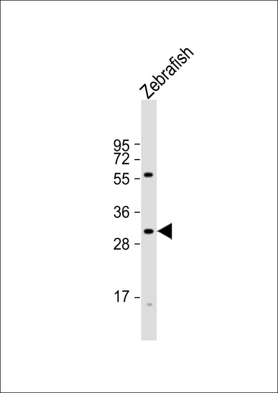 HOXD11A Antibody in Western Blot (WB)