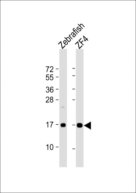 NDUFAF3 Antibody in Western Blot (WB)