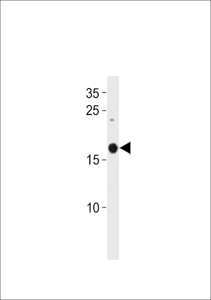 SELM Antibody in Western Blot (WB)