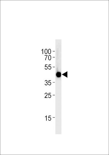 IRF2BP2A Antibody in Western Blot (WB)