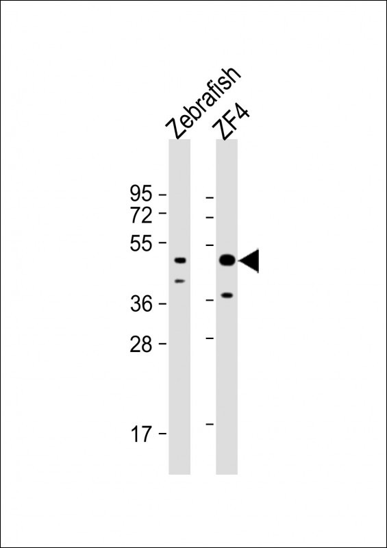ATG4B Antibody in Western Blot (WB)