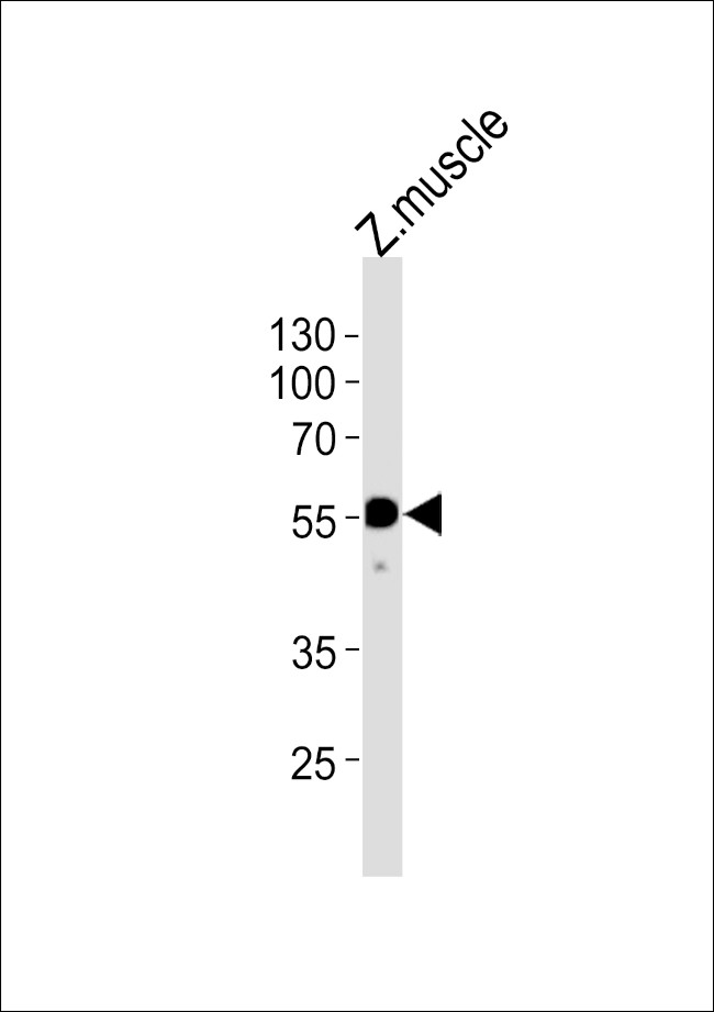 HNF1BB Antibody in Western Blot (WB)