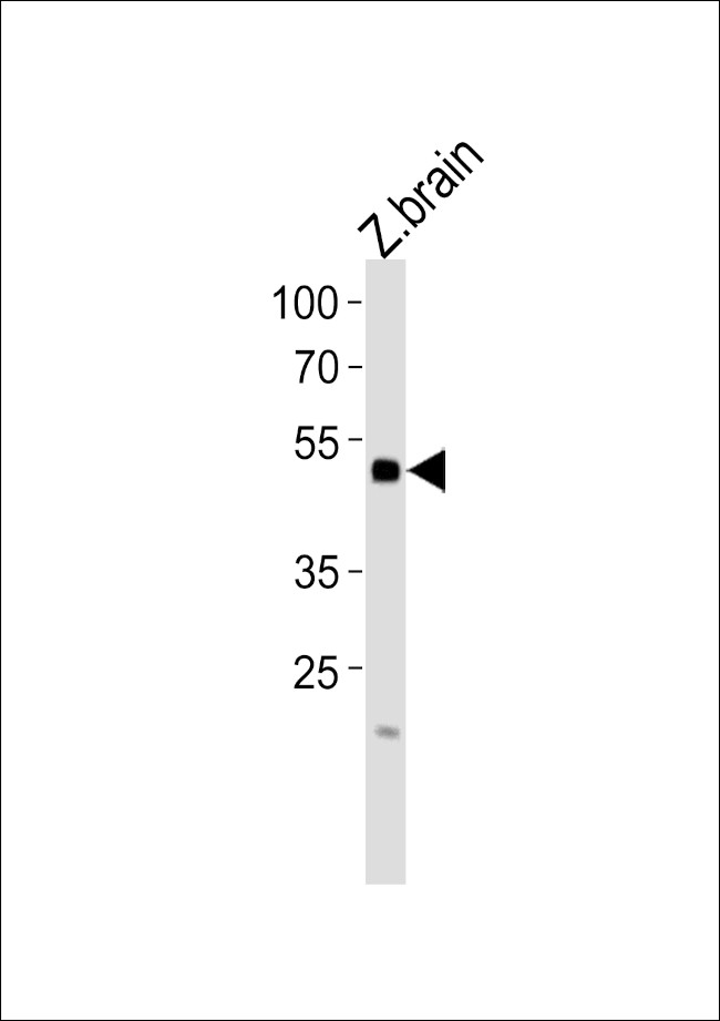 IRF2BP2B Antibody in Western Blot (WB)