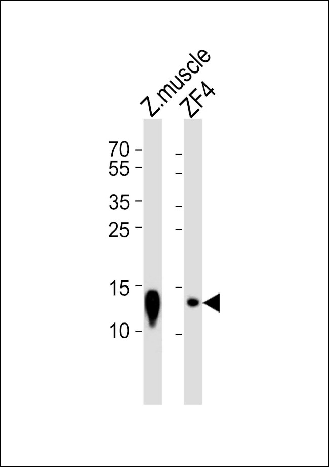 BA2 Antibody in Western Blot (WB)