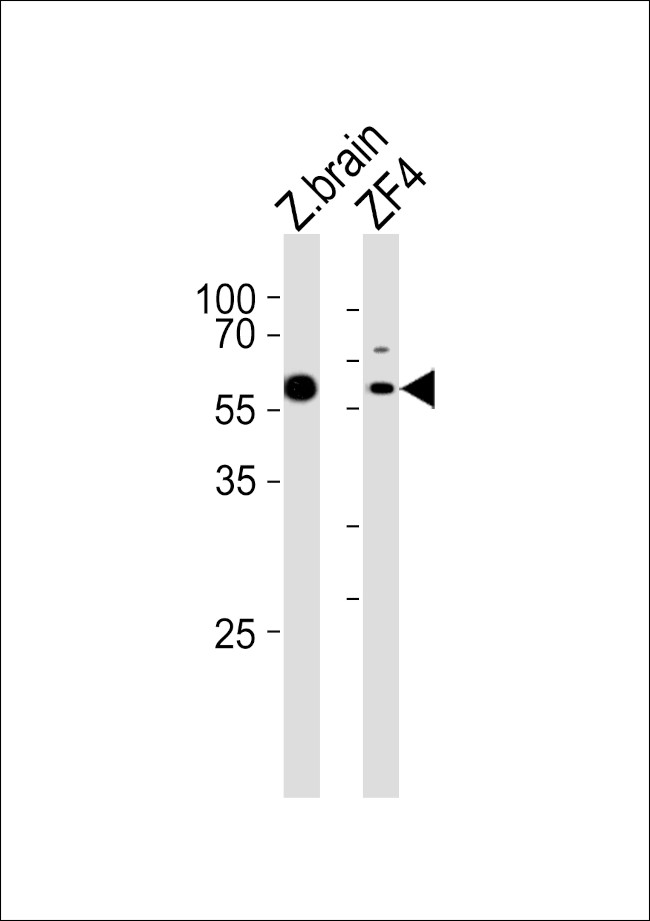 PAPL Antibody in Western Blot (WB)
