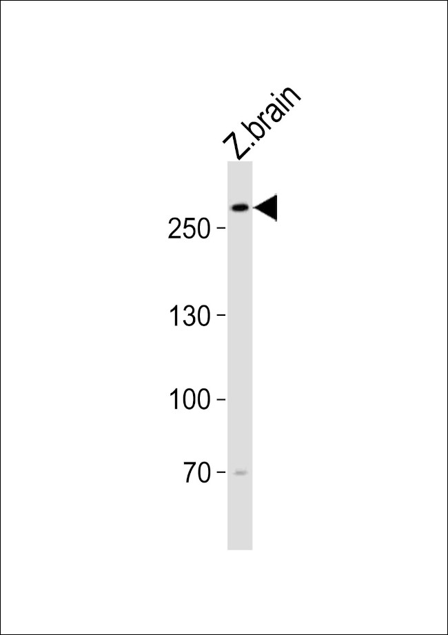 TRIO Antibody in Western Blot (WB)