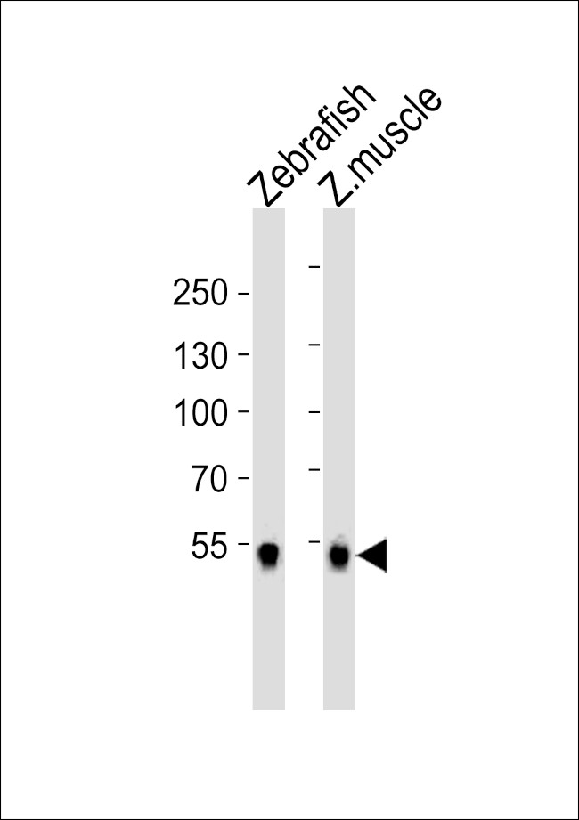 SREBP2 Antibody in Western Blot (WB)
