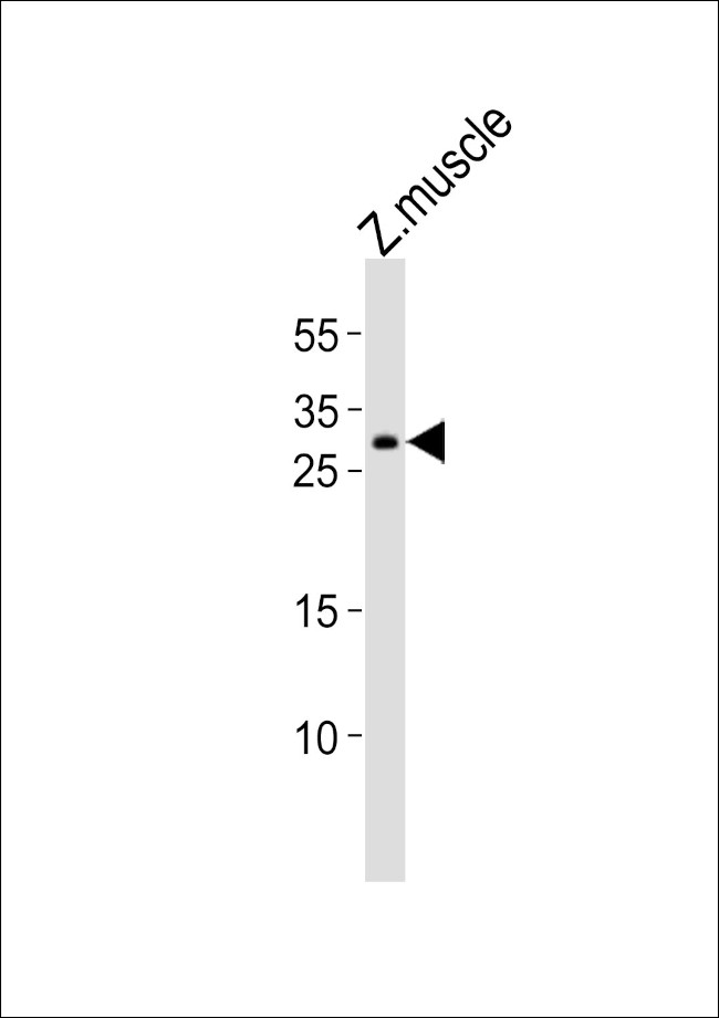 HOXB6A Antibody in Western Blot (WB)