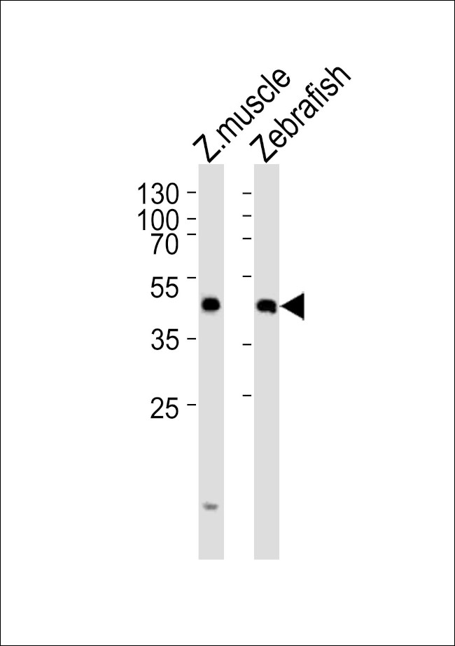 DIXDC1A Antibody in Western Blot (WB)