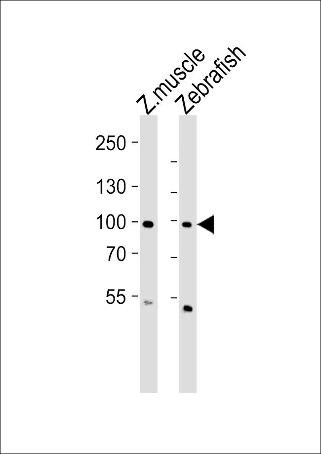 ZNF148 Antibody in Western Blot (WB)