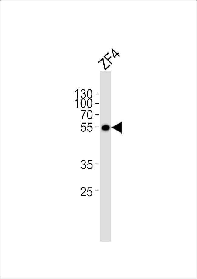 ANKRD13C Antibody in Western Blot (WB)