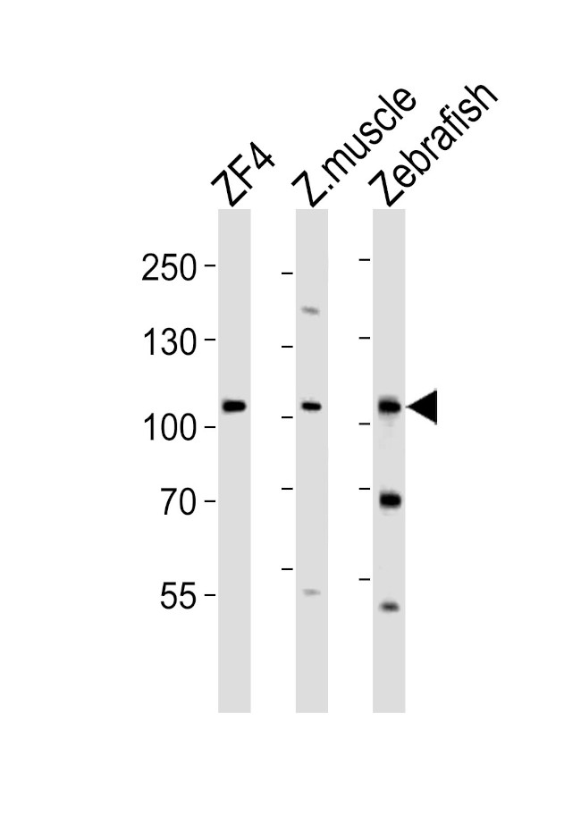 CCP2 Antibody in Western Blot (WB)
