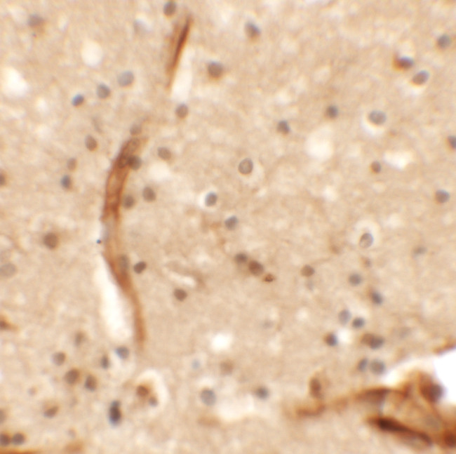 KCNK13 Antibody in Immunohistochemistry (Paraffin) (IHC (P))