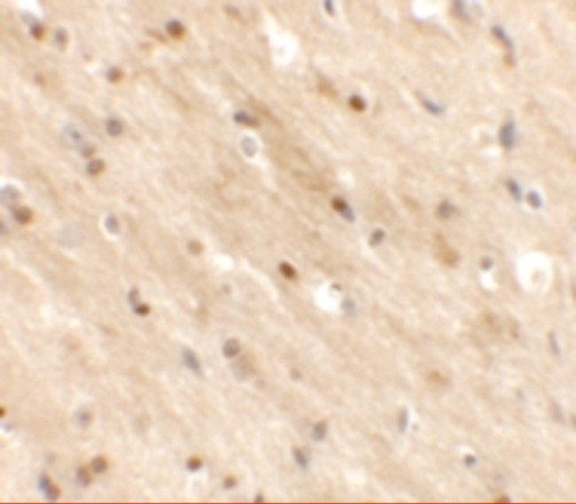TMEM59L Antibody in Immunohistochemistry (Paraffin) (IHC (P))