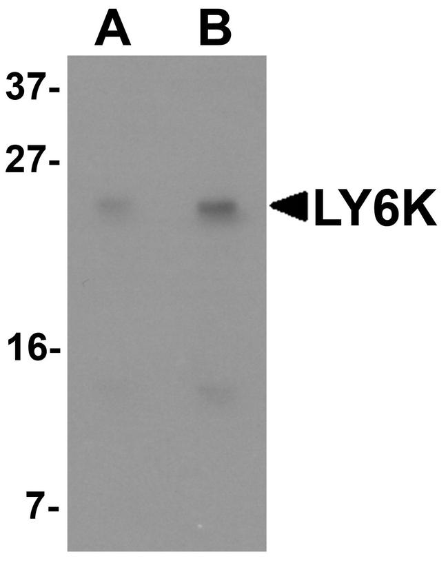 LY6K Antibody in Western Blot (WB)