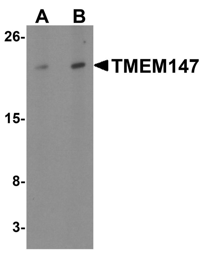 TMEM147 Antibody in Western Blot (WB)