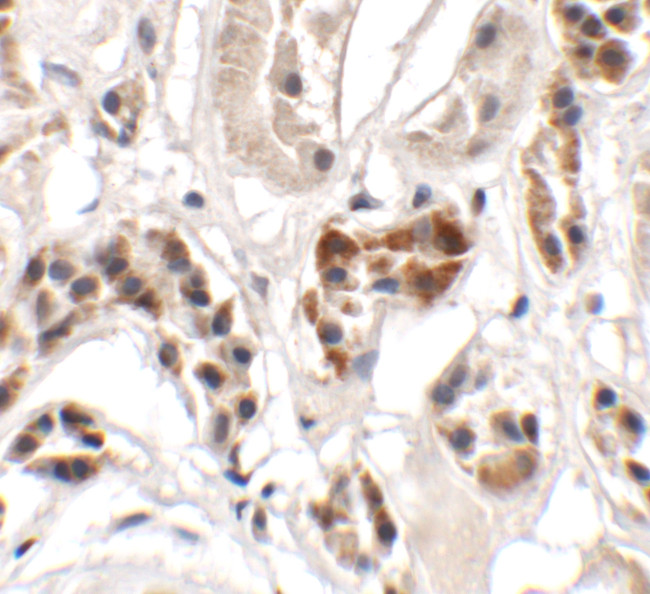 UHRF1BP1 Antibody in Immunohistochemistry (Paraffin) (IHC (P))