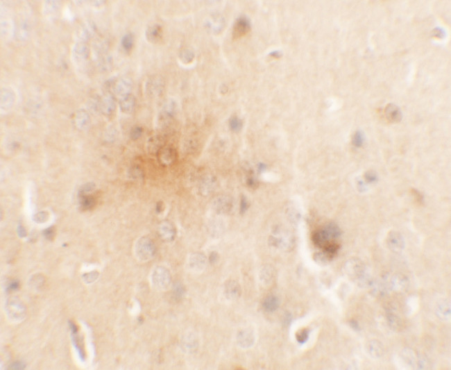 SEC62 Antibody in Immunohistochemistry (Paraffin) (IHC (P))