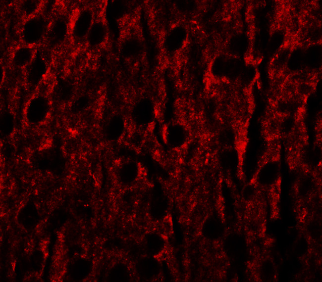 RILPL1 Antibody in Immunocytochemistry (ICC/IF)