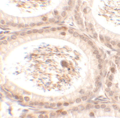 SPATA3 Antibody in Immunohistochemistry (Paraffin) (IHC (P))