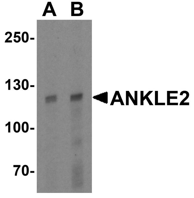ANKLE2 Antibody in Western Blot (WB)