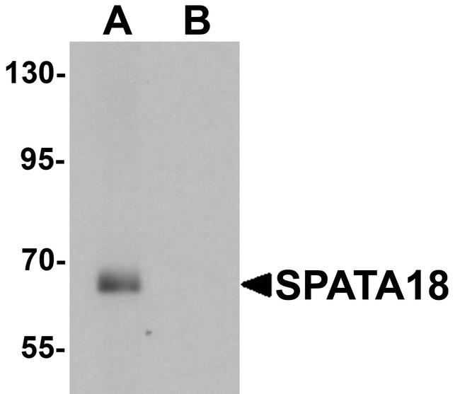 SPATA18 Antibody in Western Blot (WB)