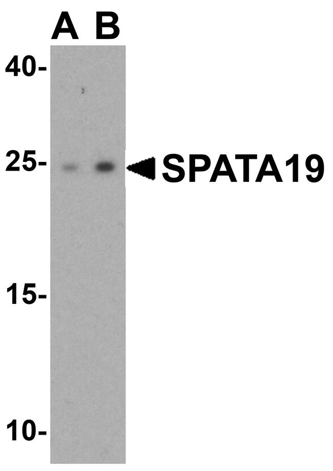 SPATA19 Antibody in Western Blot (WB)