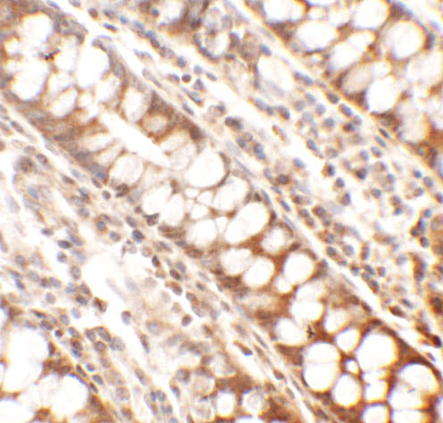 PPHLN1 Antibody in Immunohistochemistry (Paraffin) (IHC (P))