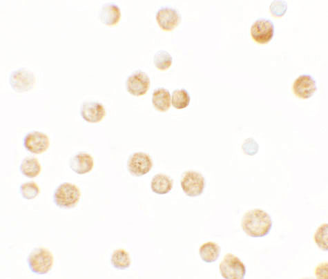 GBP6 Antibody in Immunocytochemistry (ICC/IF)