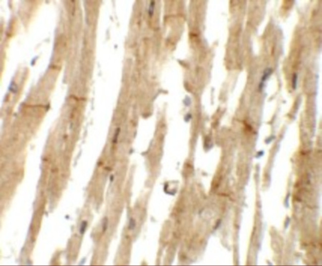 MLIP Antibody in Immunohistochemistry (Paraffin) (IHC (P))