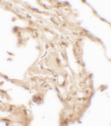 WFDC2 Antibody in Immunohistochemistry (Paraffin) (IHC (P))