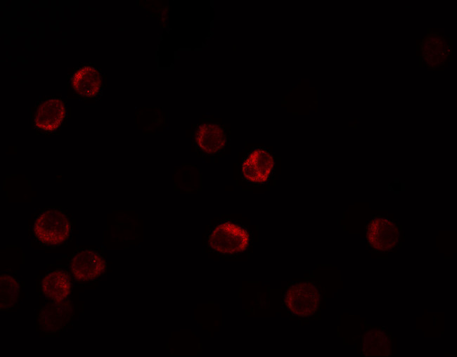 IL-28B Antibody in Immunocytochemistry (ICC/IF)