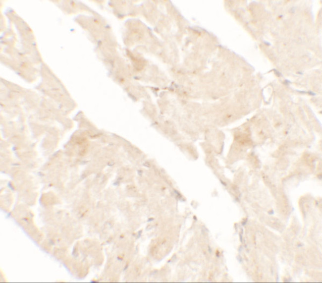 JTV-1 Antibody in Immunohistochemistry (Paraffin) (IHC (P))