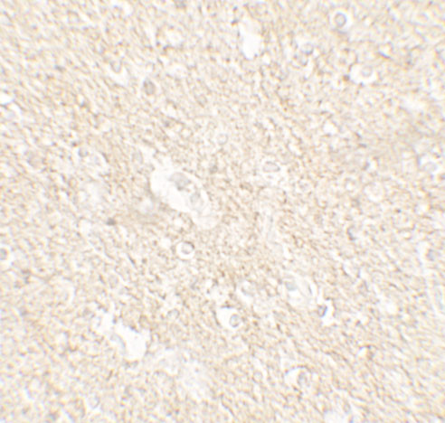 PAT1 Antibody in Immunohistochemistry (Paraffin) (IHC (P))